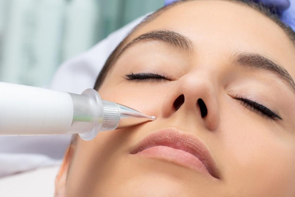 Fibroblast Facial Treatment: A Natural Alternative to Botox