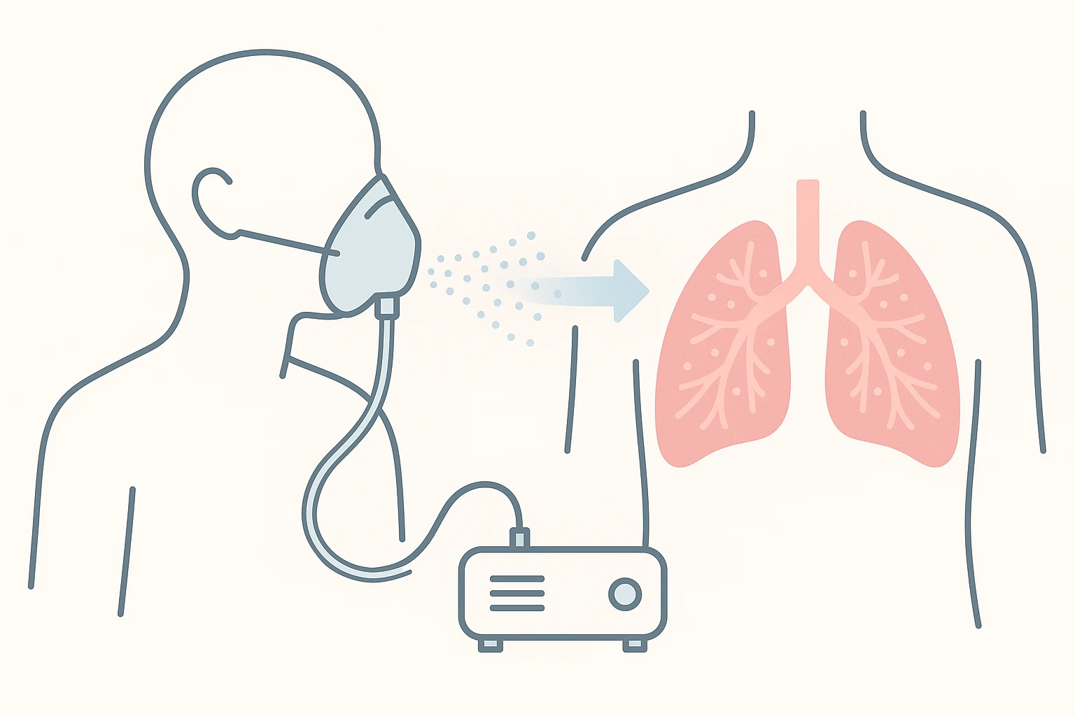Flat medical diagram showing a person in profile wearing a nebulizer mask connected to a device, with mist particles entering the lungs.